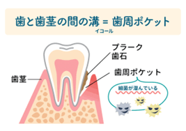 あなたの歯周ポケットは何ミリですか？